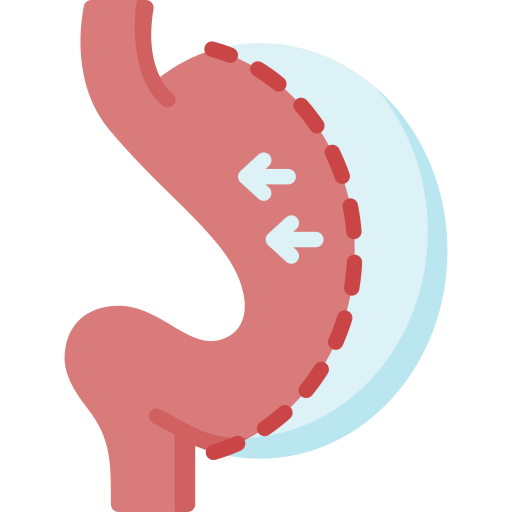 Cirugía bariátrica